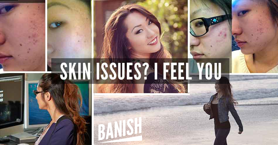 image of banish skin care users